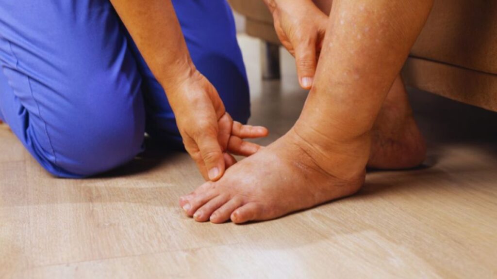 A healthcare professional in blue scrubs gently examines the swollen lower leg and foot of a patient sitting on a couch, highlighting lymphedema management services and compassionate care for swelling and discomfort.