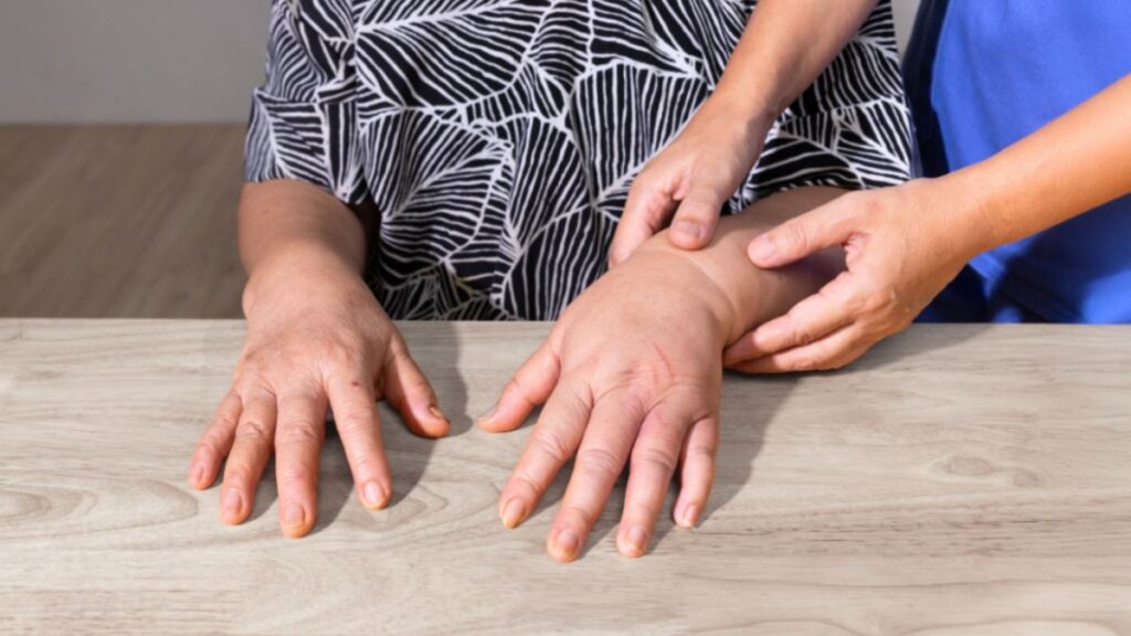 A lymphedema therapist checks a woman’s swelling arm, symbolizing the need for lymphedema therapy services to alleviate symptoms.