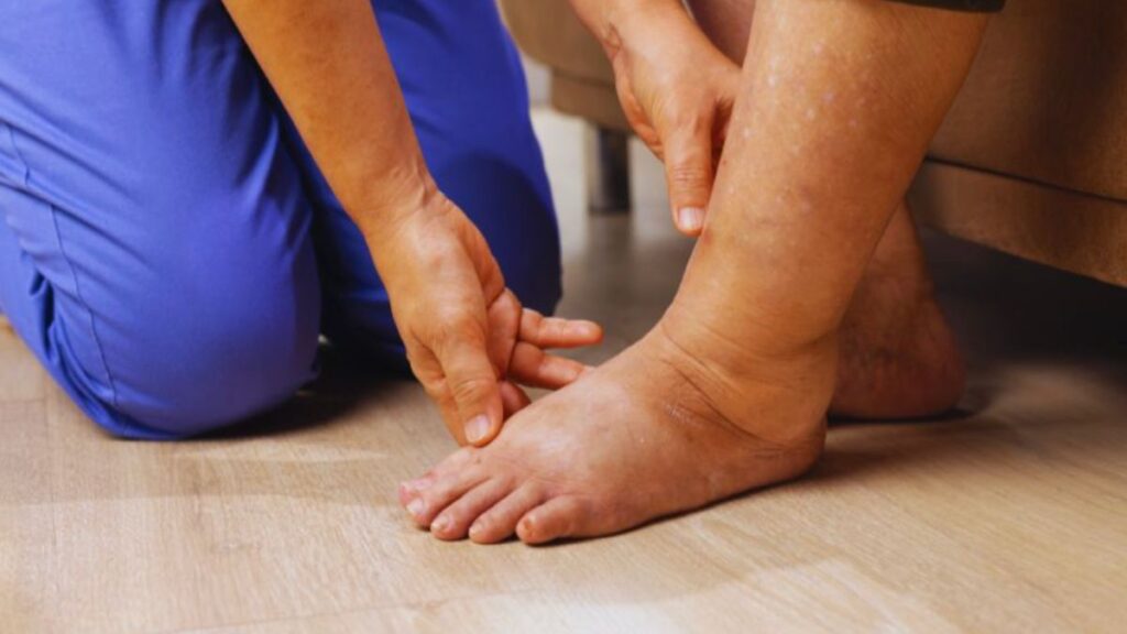 A therapist in blue scrubs gently performs manual lymphatic drainage (MLD) on a person’s swollen lower leg and foot while the person sits on a couch, illustrating a therapeutic session in Miami.